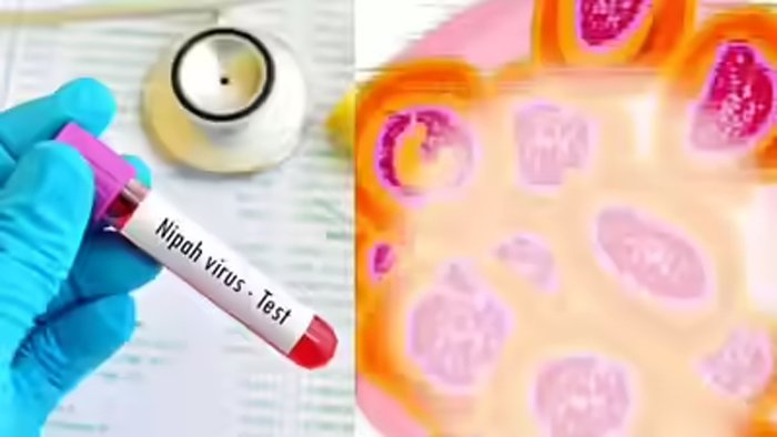 बंगाल में डरा रहा निपाह वायरस! 2 नए संदिग्ध मरीज मिले, अस्पताल में भर्ती